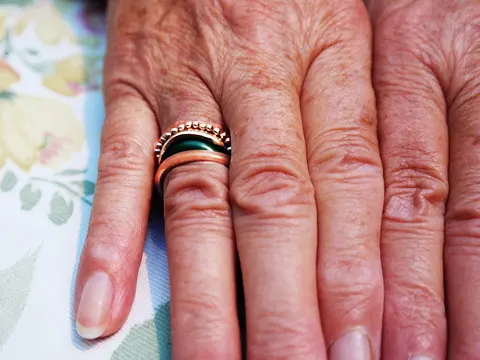 woman's worn hands - SILICON RINGS ON CALLOUSED HANDS by Franson Thiel
